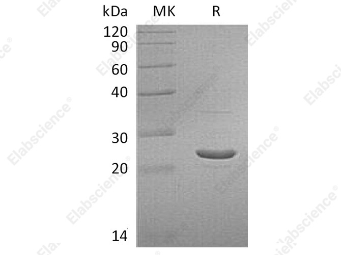 Recombinant Human GSTP1 Protein - 1
