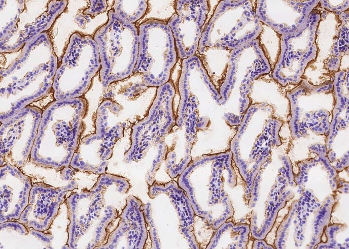 Recombinant CEACAM1/CD66a Monoclonal Antibody - small - 3