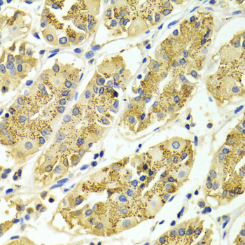 Immunohistochemistry of paraffin-embedded Human gastric using ARHGAP25 Polyclonal Antibody at dilution of 1:100 (40x lens).