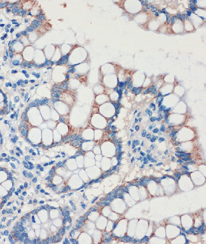 Immunohistochemistry of paraffin-embedded Human colon using CHDH Polyclonal Antibody at dilution of 1:100 (40x lens).Perform microwave antigen retrieval with 10 mM PBS buffer pH 7.2 before commencing with IHC staining protocol.