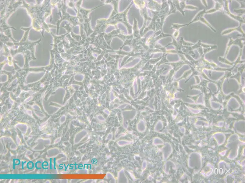 LNCaP clone FGC Cell Complete Medium - small - 5