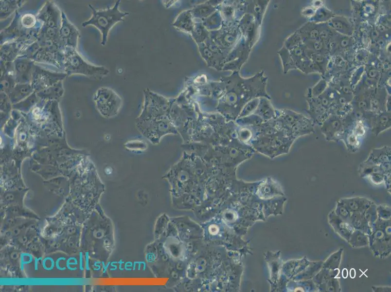 NCI-H1395 Cell Complete Medium - 6
