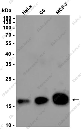 Recombinant HMGA1 Monoclonal Antibody - 1
