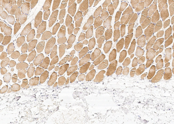 Recombinant PHPT1 Monoclonal Antibody - small - 3
