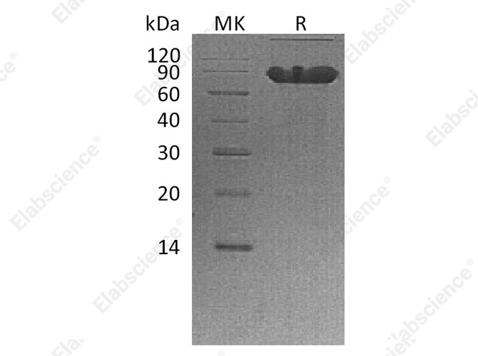 Recombinant Human CD44 Protein (Fc Tag) - 1