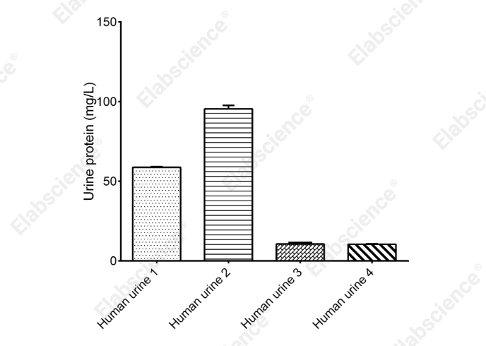 Urine Protein Colorimetric Assay Kit - 2