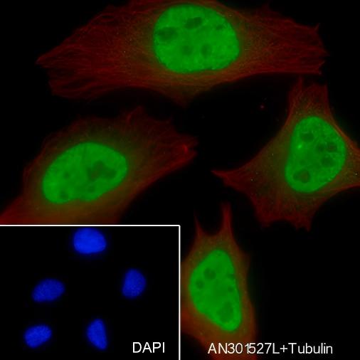 Recombinant FUBP1 Monoclonal Antibody - small - 6