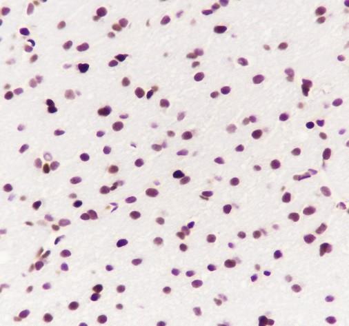 Recombinant HMGB2 Monoclonal Antibody - small - 4