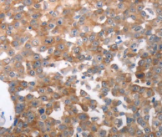 NQO2 Polyclonal Antibody - 2