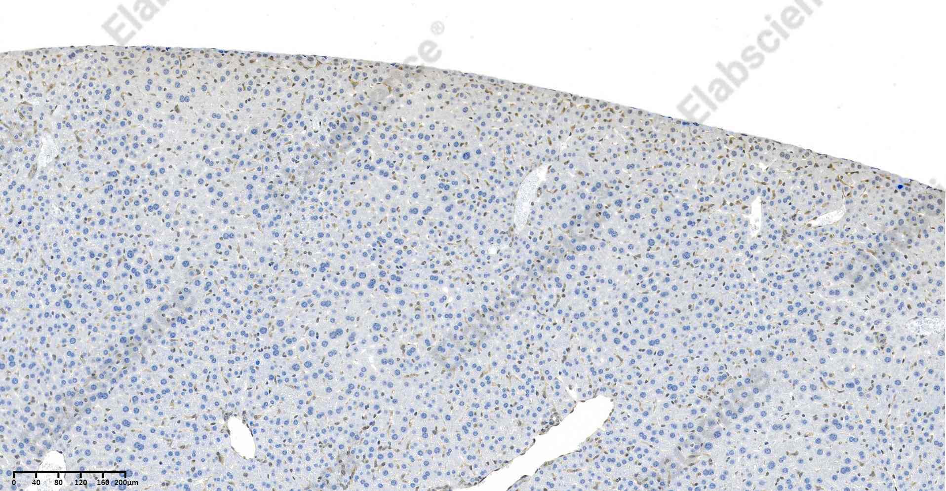 Recombinant ERK1/2 Monoclonal Antibody - 4