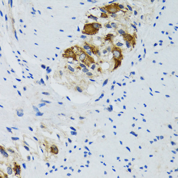 Immunohistochemistry of paraffin-embedded Human colon using HYOU1 Polyclonal Antibody at dilution of 1:100 (40x lens).