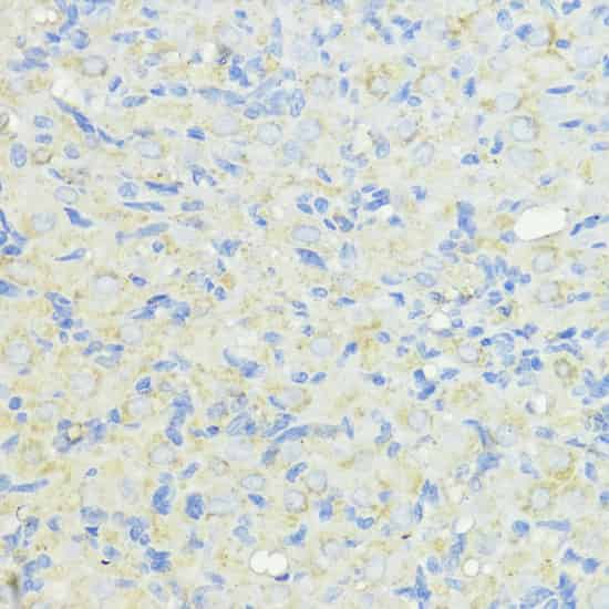 Immunohistochemistry of paraffin-embedded Rat ovary using CTSB Polyclonal Antibody at dilution of  1:100 (40x lens).