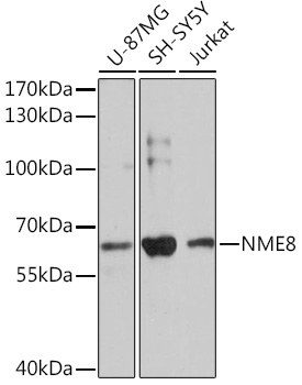 Western blot analysis of extracts of various cell lines using NME8 Polyclonal Antibody at1:3000 dilution.