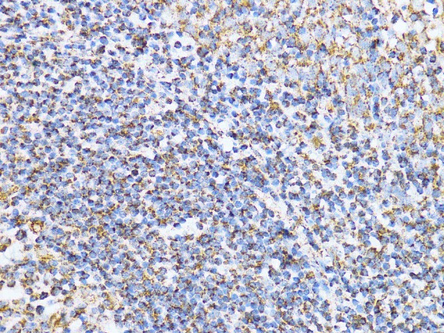 Immunohistochemistry of paraffin-embedded Human tonsil using Aconitase 2 (ACO2) Polyclonal antibody at dilution of 1:100 (40x lens).Perform microwave antigen retrieval with 10 mM PBS buffer pH 7.2 before commencing with IHC staining protocol.