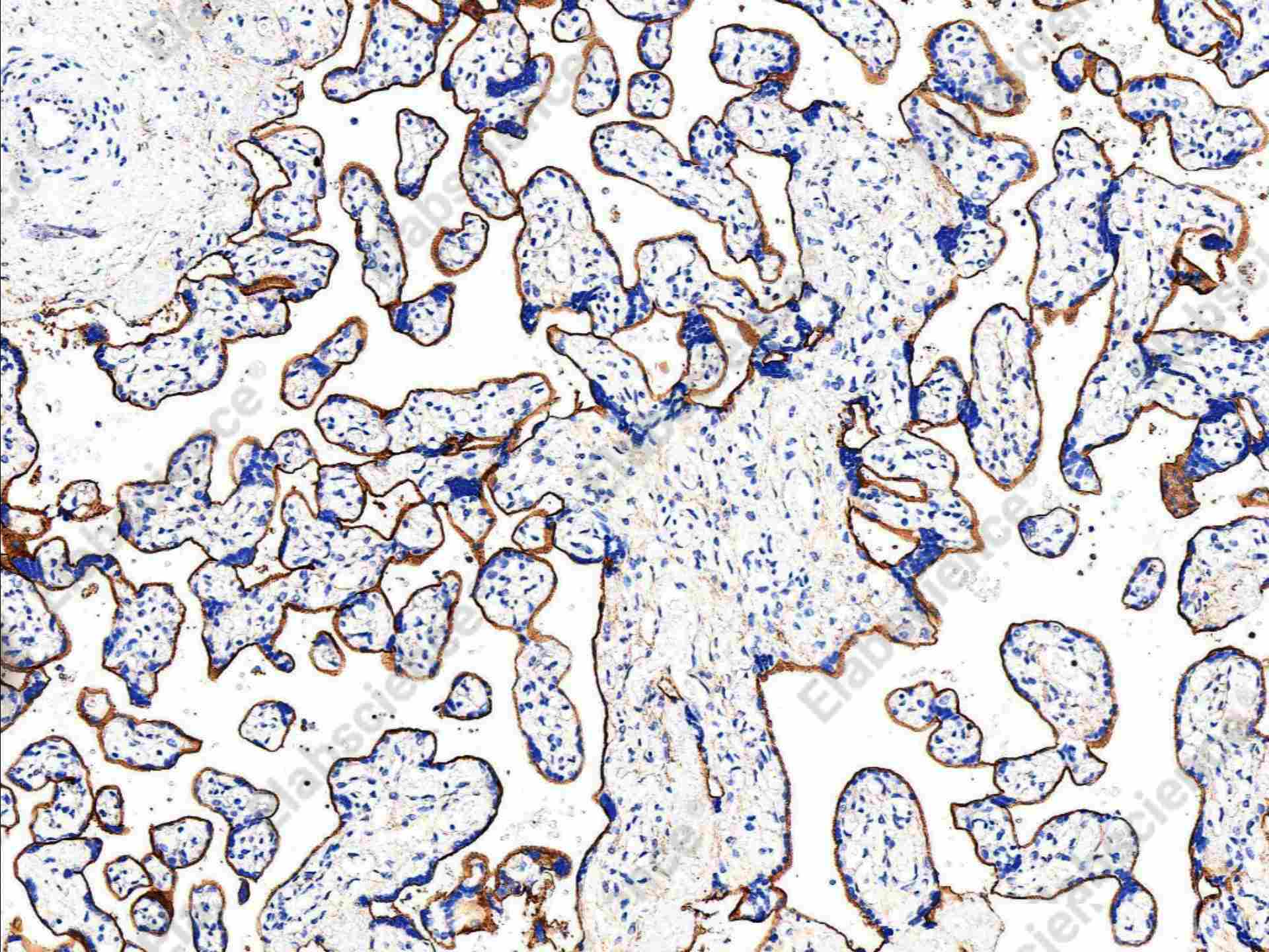 Recombinant Endoglin/CD105 Monoclonal Antibody - 1