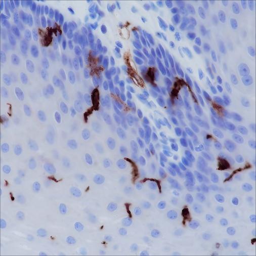 Recombinant CD1a Monoclonal Antibody-searchlist-1