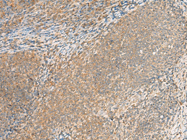 Immunohistochemistry of paraffin-embedded Human tonsil tissue  using EXD2 Polyclonal Antibody at dilution of 1:55(?200)