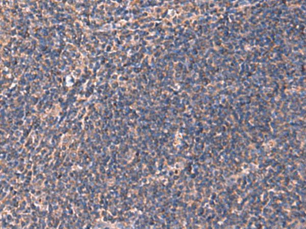 Immunohistochemistry of paraffin-embedded Human tonsil tissue  using RHAG Polyclonal Antibody at dilution of 1:130(?200)