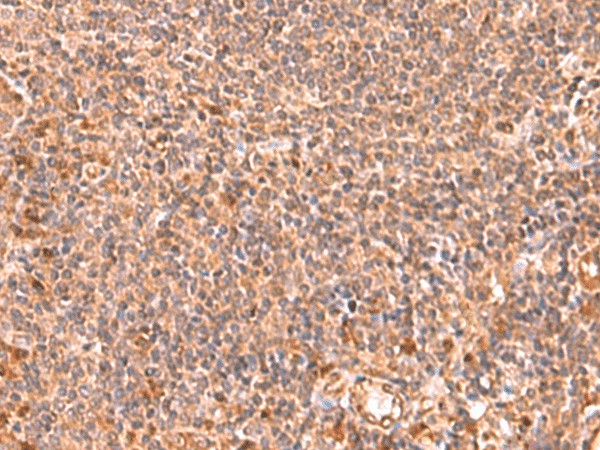 Immunohistochemistry of paraffin-embedded Human tonsil tissue  using RABEPK Polyclonal Antibody at dilution of 1:85(?200)