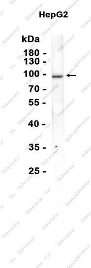 Recombinant TLE1 Monoclonal Antibody - 1