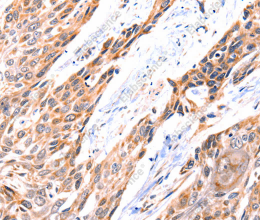 GNRHR Polyclonal Antibody - 3