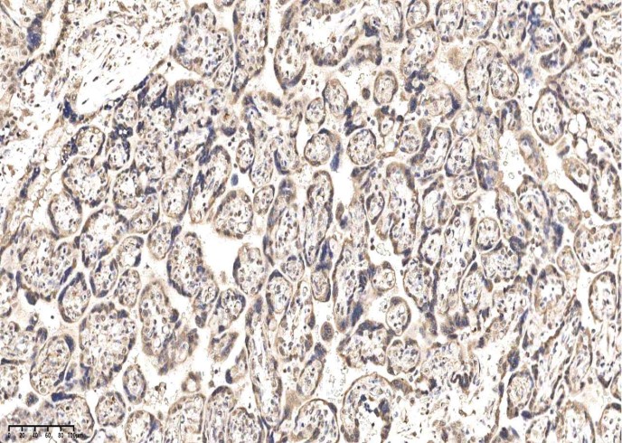 IGSF3 Monoclonal Antibody-searchlist-1