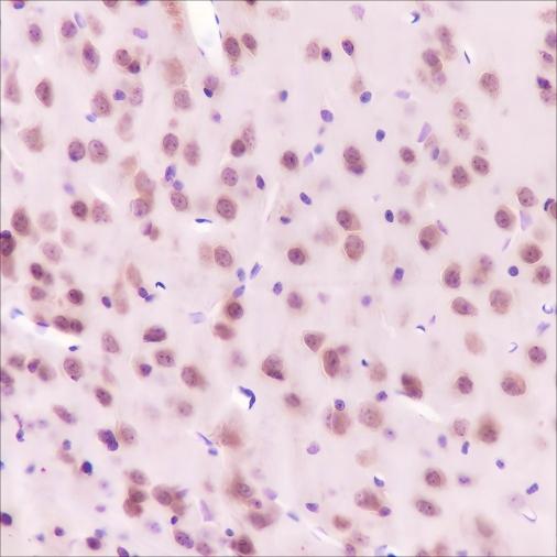 Recombinant HSP90 beta Monoclonal Antibody - small - 3