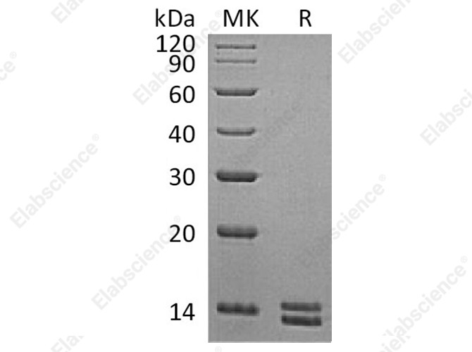 Recombinant Human S100A8&S100A9 Heterodimer Protein (His Tag) - 1