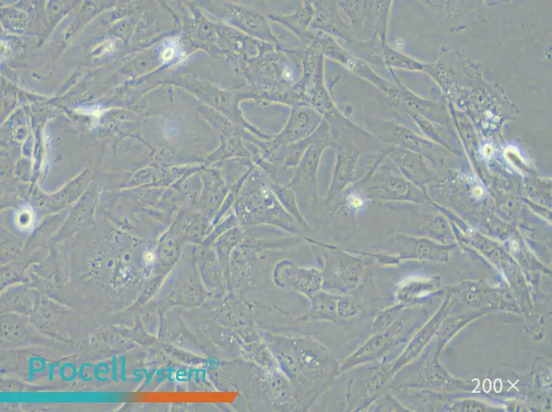 SK-LMS-1 Cell Complete Medium - 5