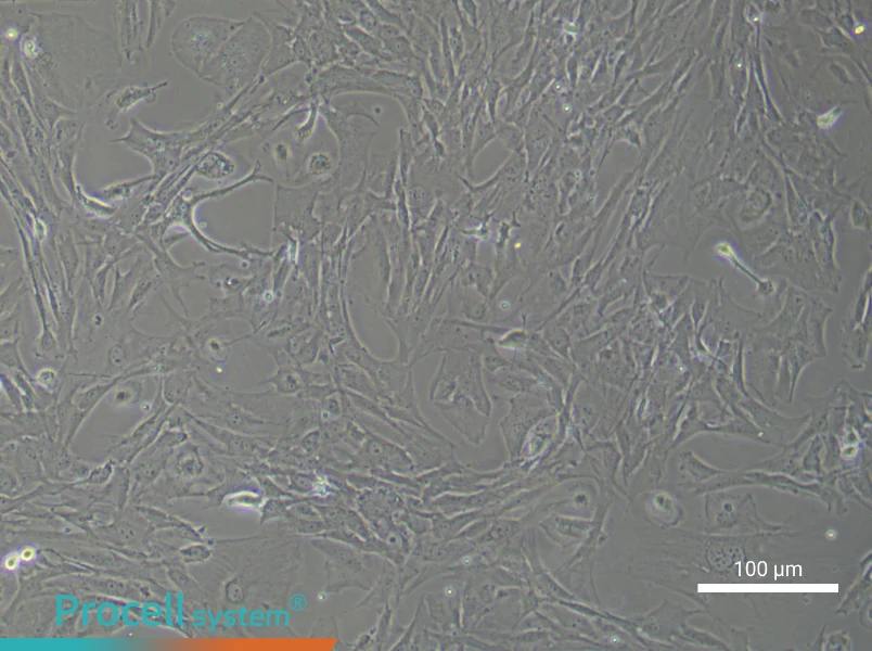 Mouse Cerebral Artery Smooth Muscle Cell Complete Medium - 3