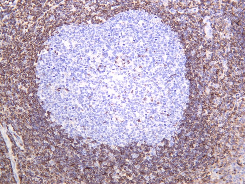 Recombinant Bcl-2 Monoclonal Antibody - small - 9