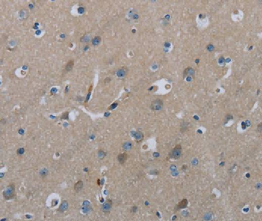 FAAH Polyclonal Antibody - 3