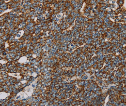 NDUFS3 Polyclonal Antibody - 2