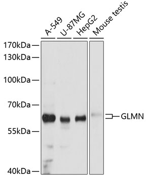 Western blot analysis of extracts of various cell lines using GLMN Polyclonal Antibody at dilution of 1:3000.