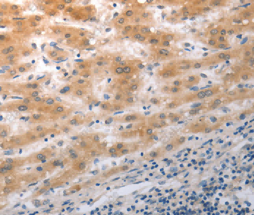 NQO2 Polyclonal Antibody - 3
