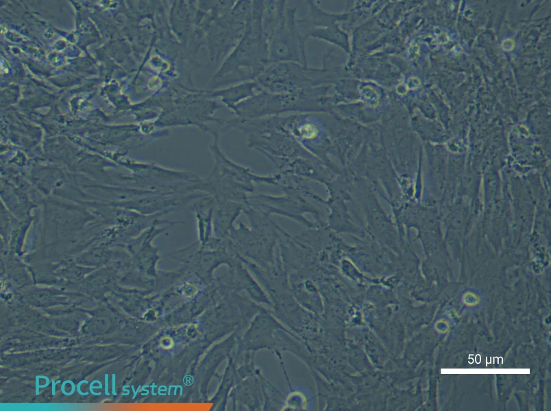 Rat Bladder Fibroblast Complete Medium - 4