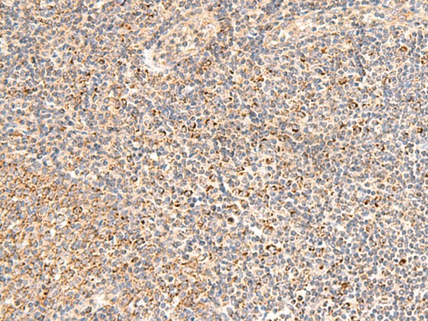 Immunohistochemistry of paraffin-embedded Human tonsil tissue  using MRPL16 Polyclonal Antibody at dilution of 1:50(?200)