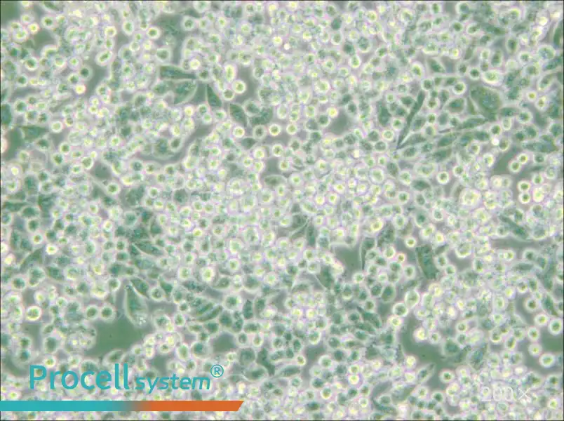 MIA PaCa-2 Cell Complete Medium - small - 6