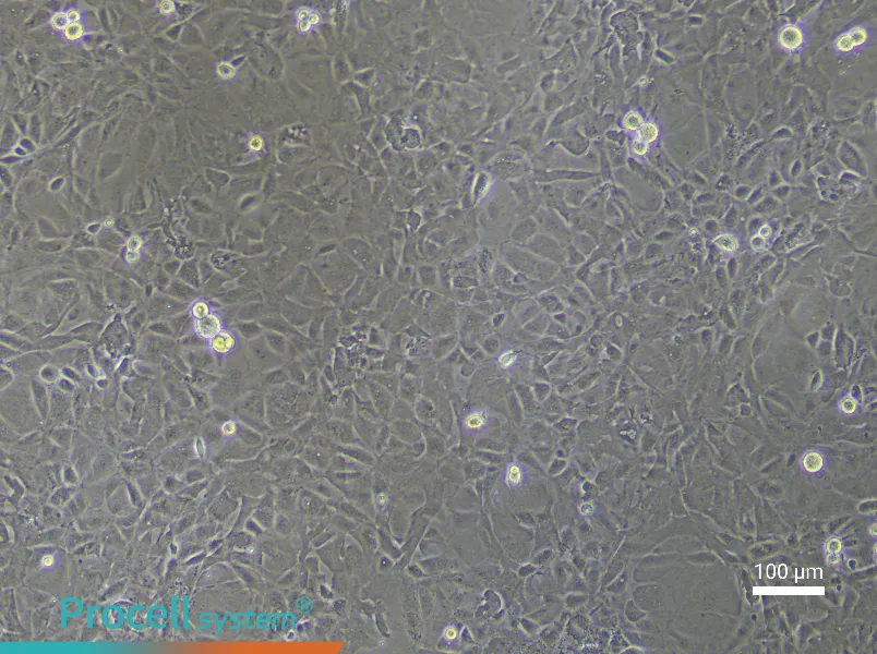 Rat Pulmonary Microvascular Endothelial Cell Complete Medium - 3