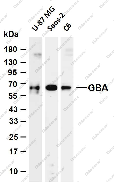 Recombinant GBA Monoclonal Antibody - 1