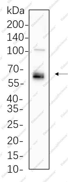 Recombinant LKB1 Monoclonal Antibody - 1