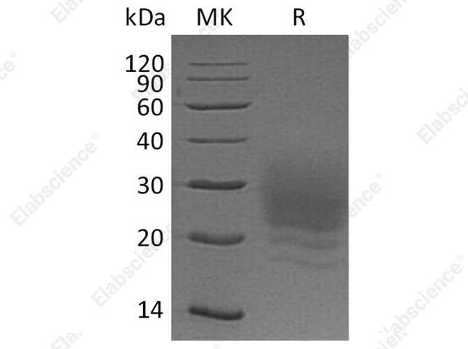 Recombinant Human BOC Protein (His Tag) - 1