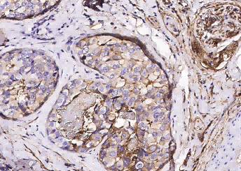 S100A10 Monoclonal Antibody - small - 5