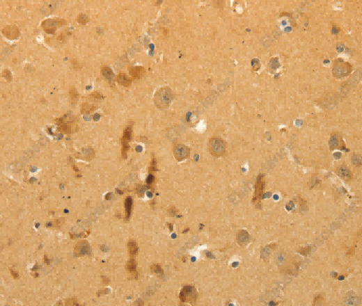 CFHR1 Polyclonal Antibody - 2