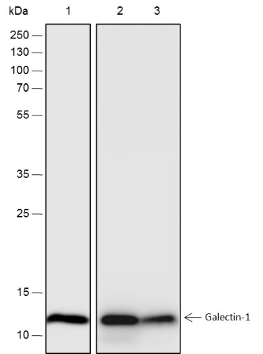 Recombinant Galectin-1 Monoclonal Antibody-searchlist-1