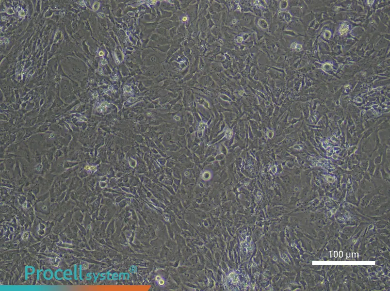 Mouse Trabecular Meshwork Cells - 1