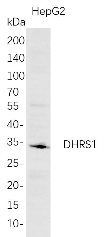 Recombinant DHRS1 Monoclonal Antibody-searchlist-1