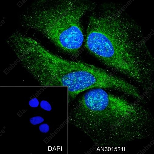 Recombinant FBXW7 Monoclonal Antibody - 3