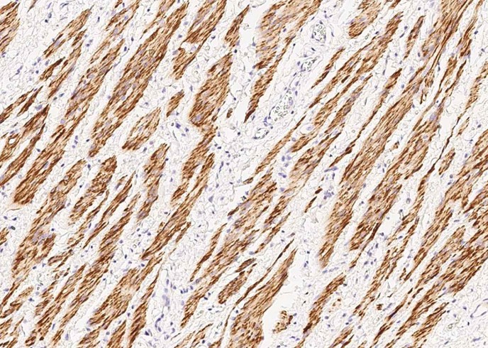 Desmin Monoclonal Antibody - small - 2