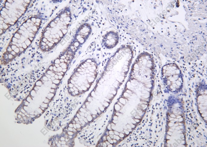 Recombinant AMPKβ1 Monoclonal Antibody - 1